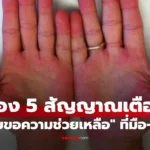 แค่ดูมือดูเท้า ก็จะรู้ว่า