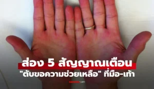 แค่ดูมือดูเท้า ก็จะรู้ว่า