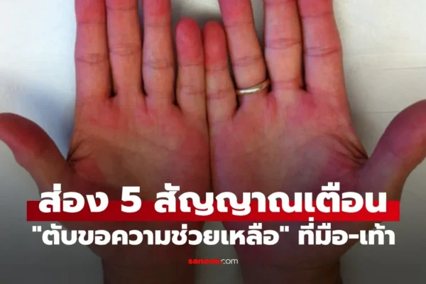 แค่ดูมือดูเท้า ก็จะรู้ว่า
